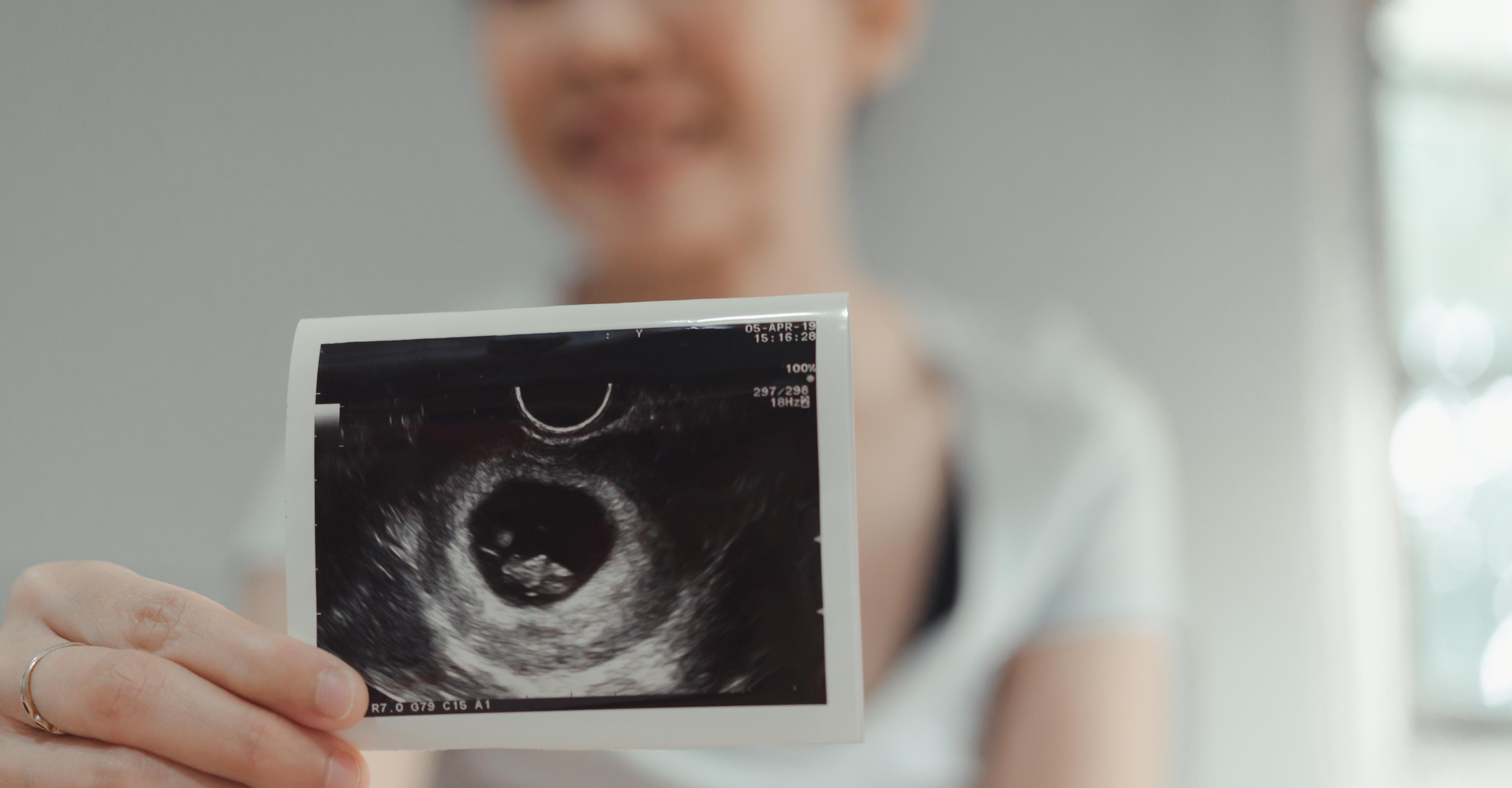 First Prenatal Visit What To Know Twill Care first-prenatal-visit-what-to-know-twill-care