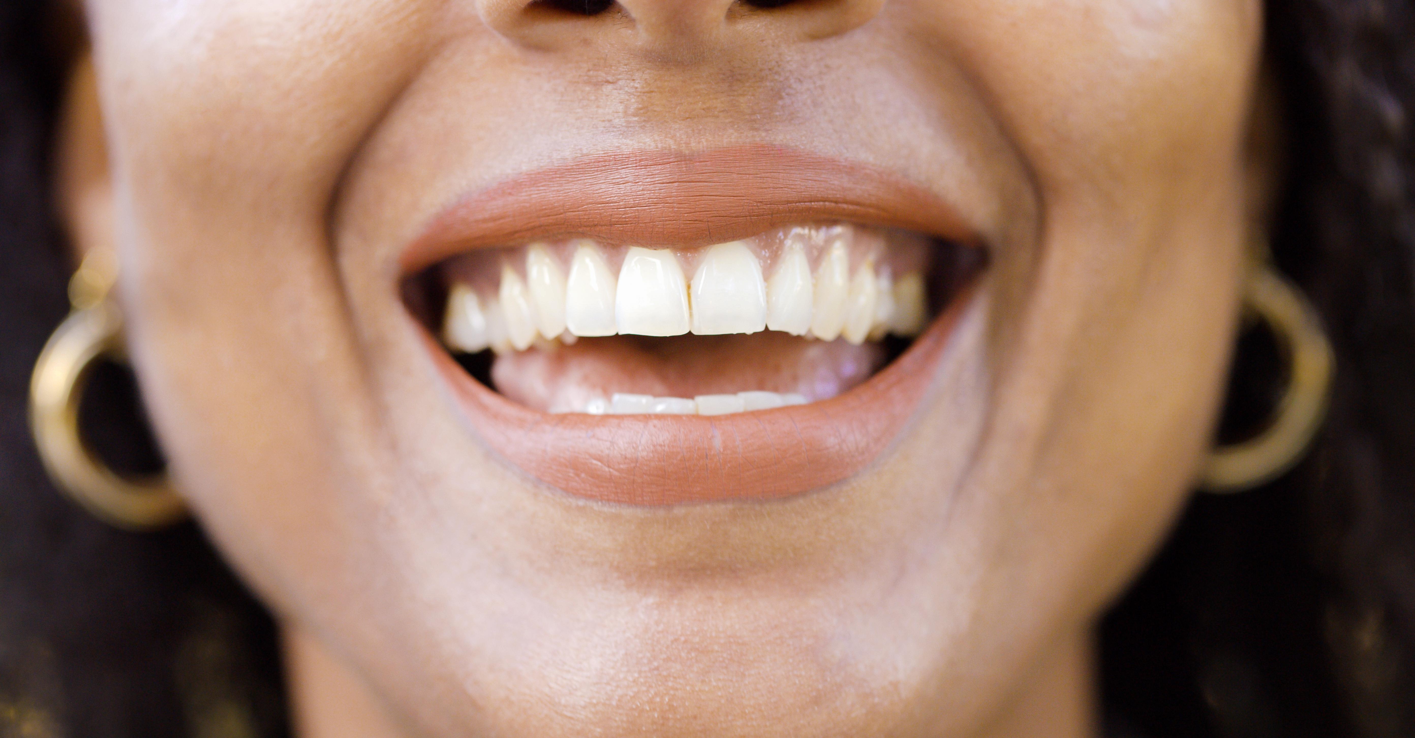 Oral Psoriasis Can I Get Psoriasis in My Mouth? Twill Care